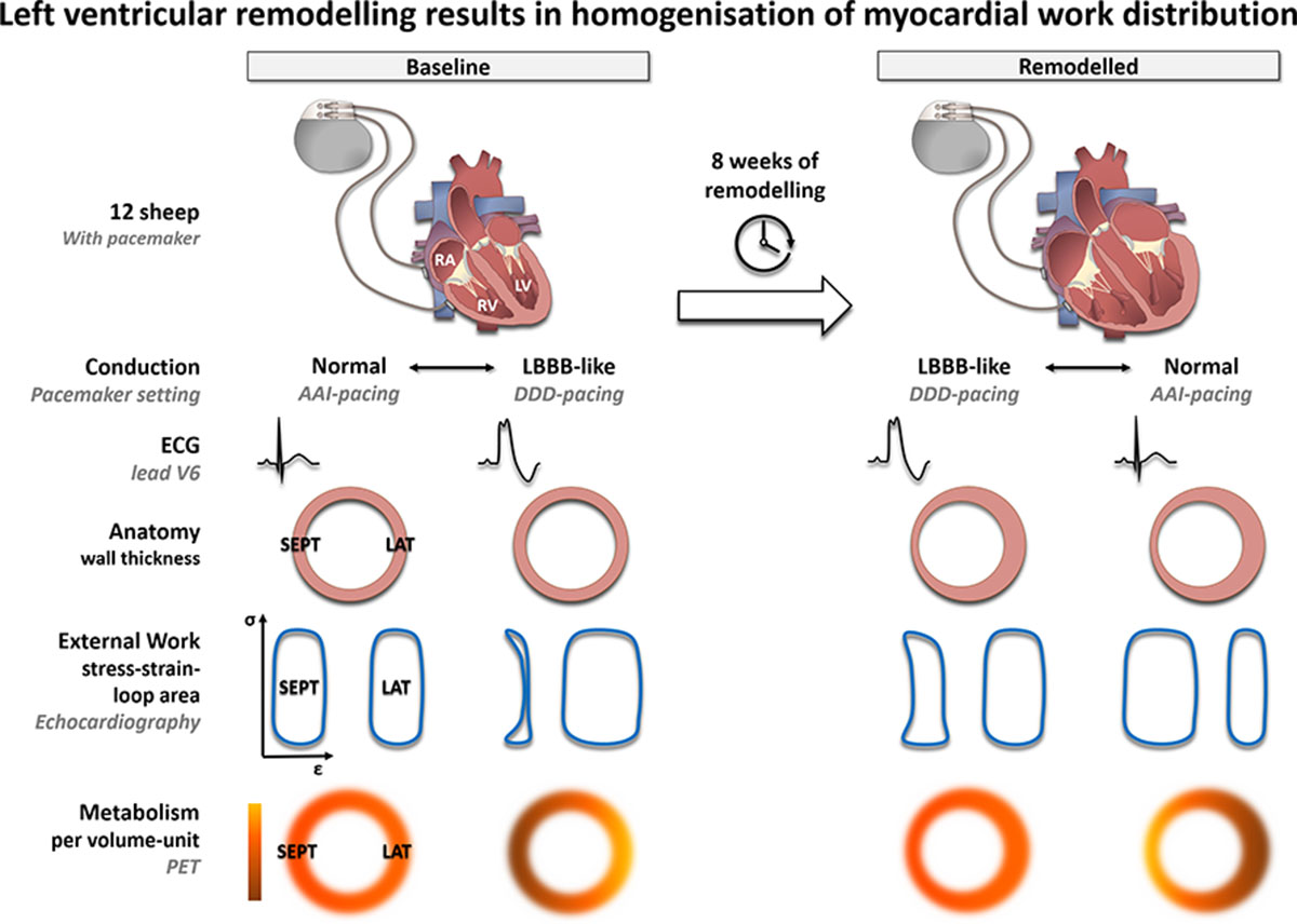 Left-Ventricular-Remodeling.jpg